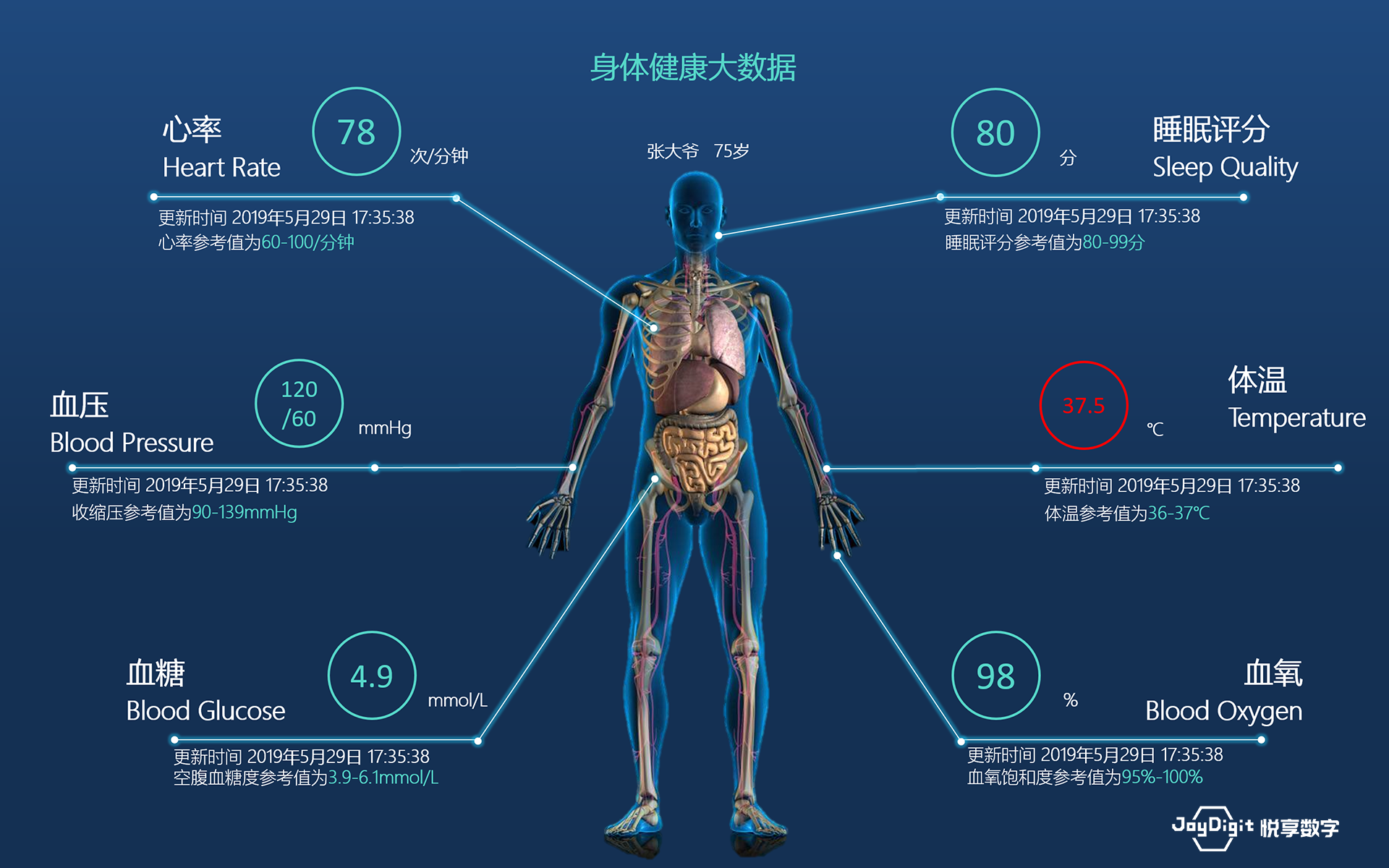 消费日报：悦享数字推动新兴技术与养老服务相结合，加快养老行业数字化转型(图9)